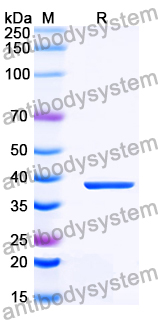 Recombinant Human COL17A1 Protein, N-GST & C-His