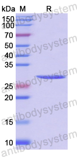 Recombinant Human EDAR Protein, N-His