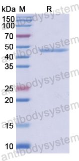 Recombinant Human PSMD13 Protein, N-His