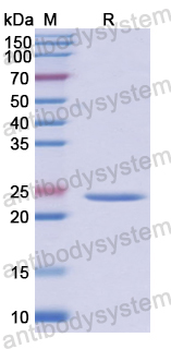 Recombinant Human CD201/PROCR Protein, N-His