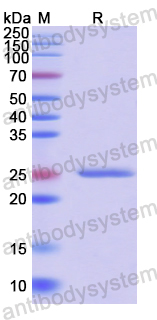 Recombinant Human FZD1 Protein, N-His