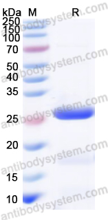 Recombinant Human TFR2 Protein, N-His