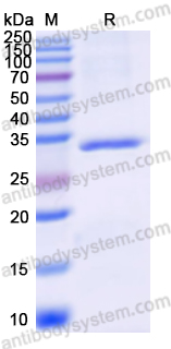 Recombinant Human DICER1 Protein, N-His