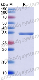 Recombinant Human CILK1 Protein, N-His
