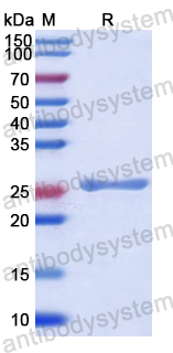 Recombinant Human RAGE-1/MOK Protein, N-His