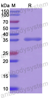 Recombinant Human BAIAP2 Protein, N-His