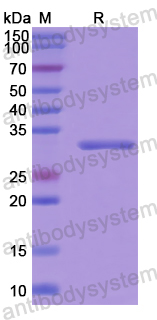 Recombinant Human AURKC Protein, N-His