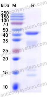 Recombinant Human HDAC5 Protein, N-His