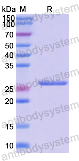 Recombinant Human SH2B3 Protein, N-His