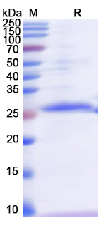 Recombinant Human NOD1 Protein, N-His