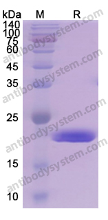 Recombinant Human AKT3 Protein, N-His