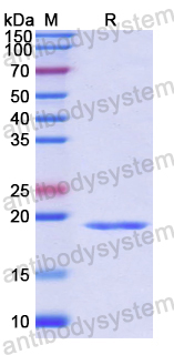 Recombinant Human PLAA Protein, N-His