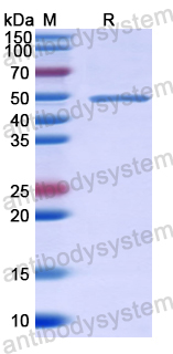 Recombinant Human ANGPT4 Protein, N-GST