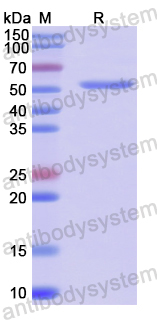 Recombinant Human RUVBL1 Protein, N-His