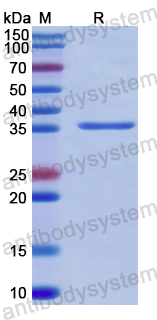 Recombinant Human INVS Protein, N-GST