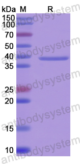 Recombinant Human CD328/SIGLEC7 Protein, N-His