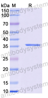 Recombinant Human CD328/SIGLEC7 Protein, N-His