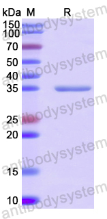 Recombinant Human TP53TG5 Protein, N-GST