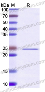 Recombinant Human PKIG Protein, N-His-KSI