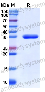 Recombinant Human B3GALT5 Protein, N-His