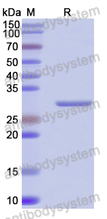 Recombinant Human CD286/TLR6 Protein, N-His