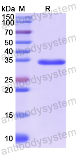 Recombinant Human CA5B Protein, N-His