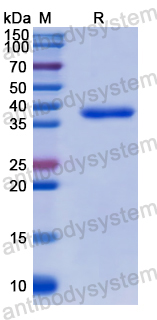 Recombinant Human NISCH Protein, N-GST