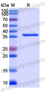 Recombinant Human CRYL1 Protein, N-His