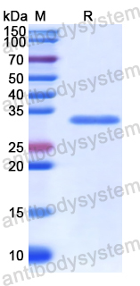 Recombinant Human AXIN2 Protein, N-His