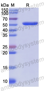 Recombinant Human GDA Protein, N-His