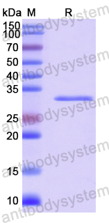 Recombinant Human KCNIP3 Protein, N-His