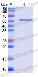 Recombinant Human COQ6 Protein, N-His
