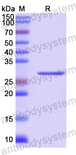 Recombinant Human NOSIP Protein, N-His