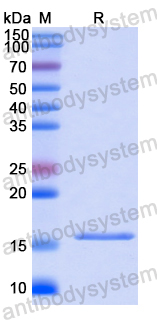 Recombinant Human FIS1 Protein, N-His