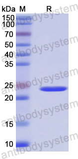 Recombinant Human TLN1 Protein, N-His