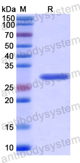 Recombinant Human IRS2 Protein, N-His