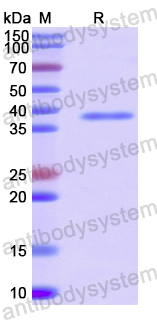 Recombinant Human MYO5A Protein, N-His