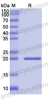 Recombinant Human TRAF6 Protein, N-His