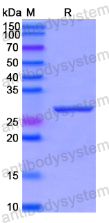 Recombinant Human MAP4K5 Protein, N-His