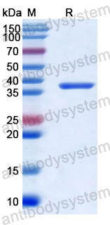 Recombinant Human CCL27/CTACK Protein, N-GST