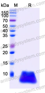 Recombinant Human CCL27/CTACK Protein, Tag free