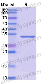 Recombinant Human CD2AP Protein, N-His