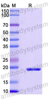 Recombinant Human CD2AP Protein, N-His-SUMO