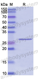Recombinant Human MMP24 Protein, N-His