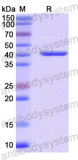 Recombinant Human SNX9 Protein, N-His