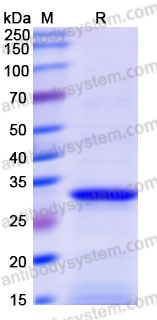 Recombinant Human LIPG Protein, N-His