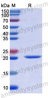 Recombinant Human BACE2 Protein, N-His