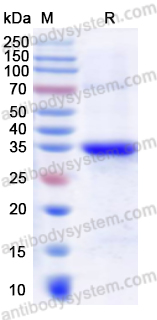Recombinant Human PSAT1 Protein, N-His