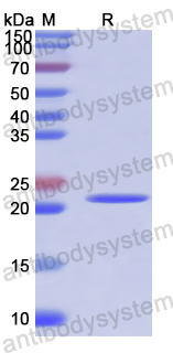 Recombinant Human CD321/F11R Protein, N-His