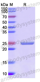 Recombinant Human AUP1 Protein, N-His